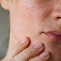 Pores and wrinkles on the skin of the face. Cleansing the face skin